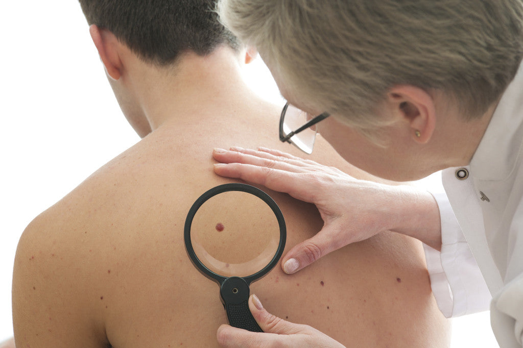 Brush On Block image doctor checking for melanoma