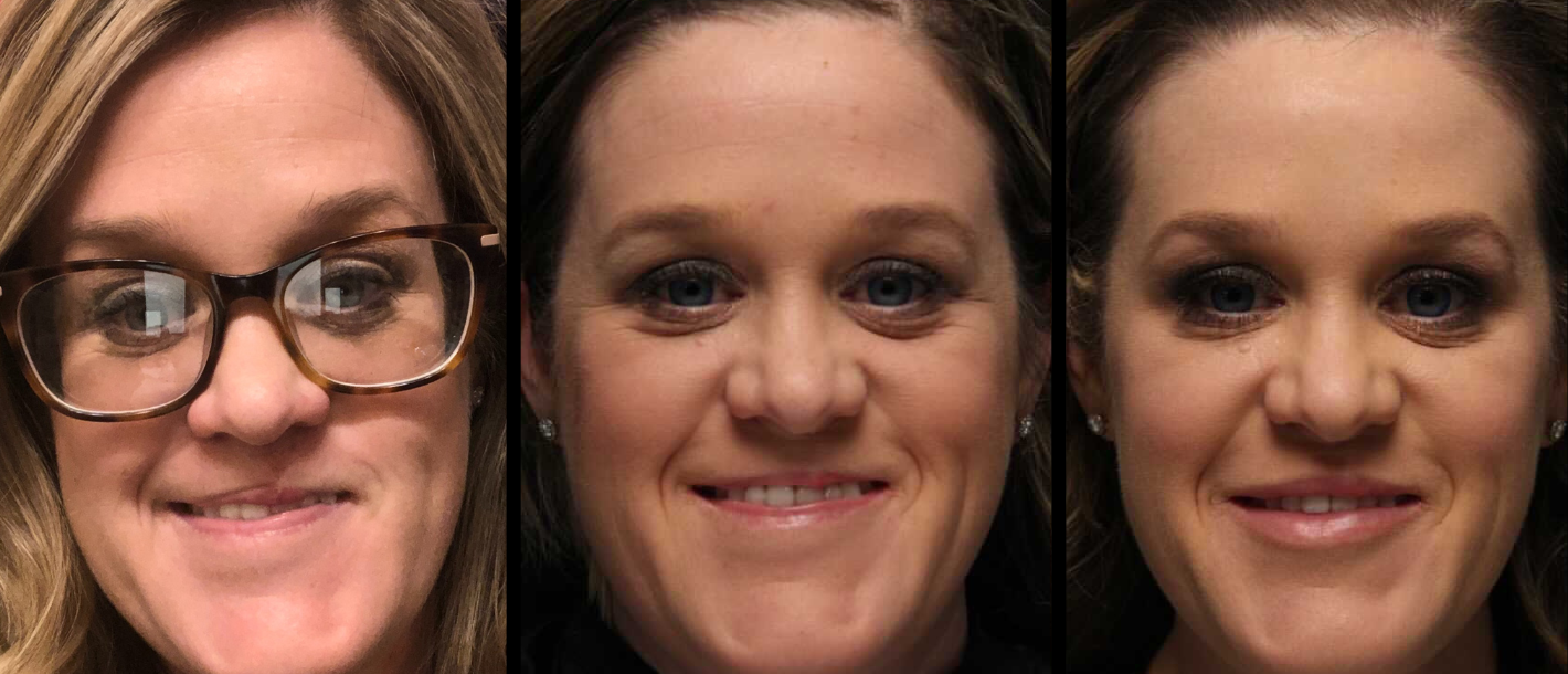 Skin Cancer Awareness Profile: Katie Tillman